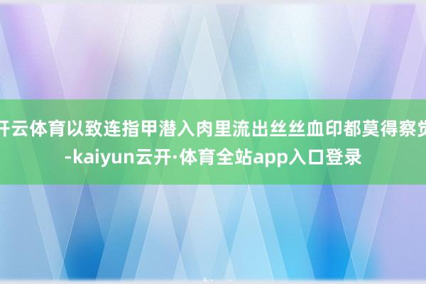 开云体育以致连指甲潜入肉里流出丝丝血印都莫得察觉-kaiyun云开·体育全站app入口登录